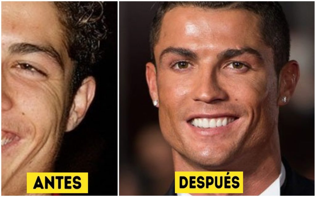 15 Personas que compartieron su increíble cambio antes y después de